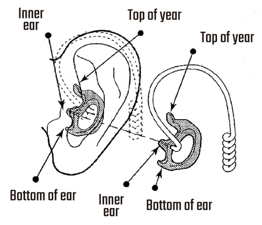 Flexible Open Ear Insert (Ear Mold) Insertion & Care